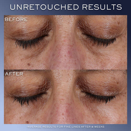 Génifique Ultimate Eye Cream 3 Génifique Ultimate Eye Cream