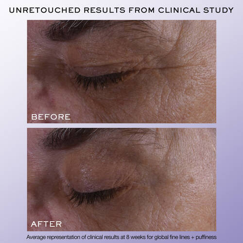 Rénergie H.C.F. Triple Serum Eye 5 Rénergie H.C.F. Triple Serum Eye