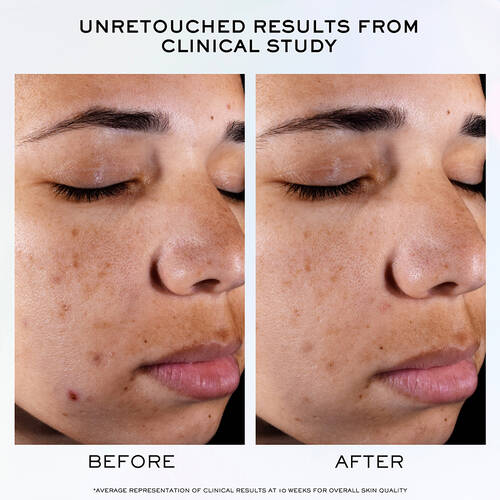 Clarifique Pro-Solution Serum 4 Clarifique Pro-Solution Serum