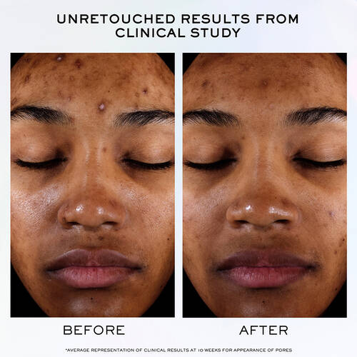 Clarifique Pro-Solution Serum 5 Clarifique Pro-Solution Serum