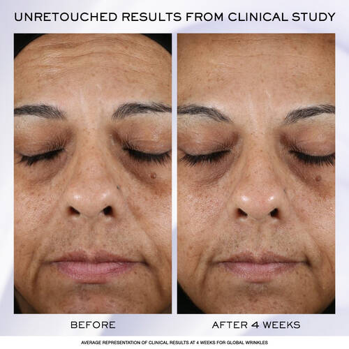 5 Rénergie H.P.N. 300-Peptide Cream